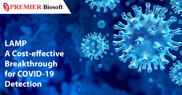 LAMP Method for COVID-19 detection using LAMP Primers